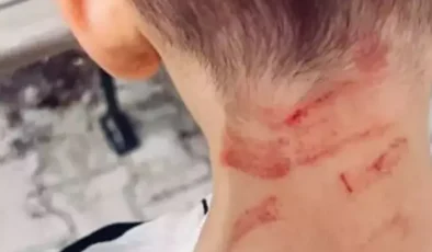 Burdur’da Özel Gereksinimli Çocuğa Darp İddiası: Soruşturma Başlatıldı