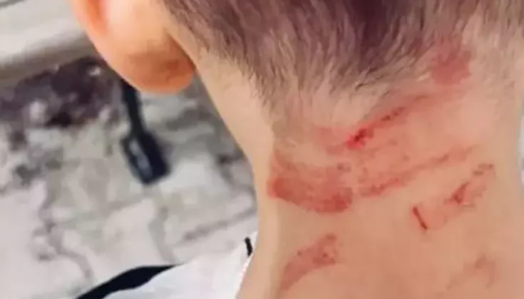 Burdur’da Özel Gereksinimli Çocuğa Darp İddiası: Soruşturma Başlatıldı